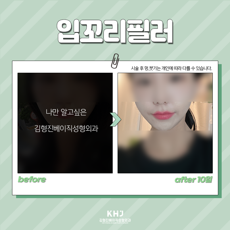 처진입꼬리 개선방법 이렇게나 간단해! 관련 이미지 4