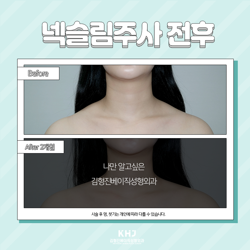 목얇아지는법 궁금하셨다면? 관련 이미지 2