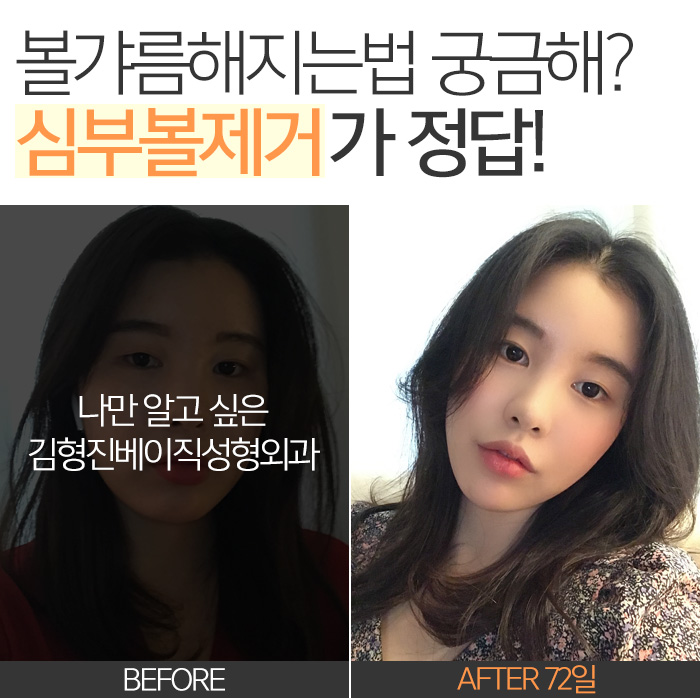 볼갸름해지는법 다 알고 있는데 관련 이미지 2