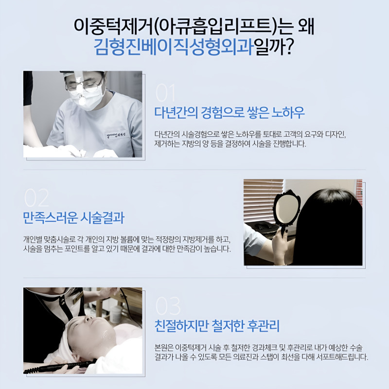 이중턱제거로 두툼한 이중 턱살 싹 없앴어요! 관련 이미지 6