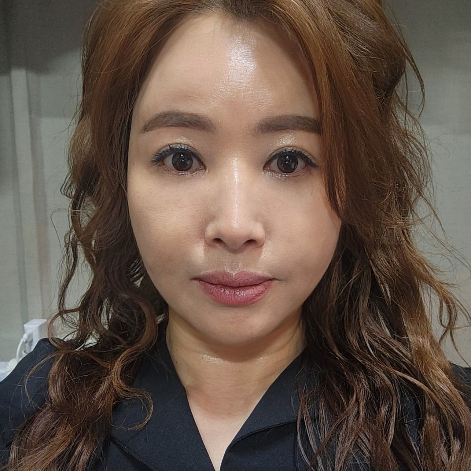 압구정하안검 잘하는 곳 찾고 있다면 관련 이미지 2