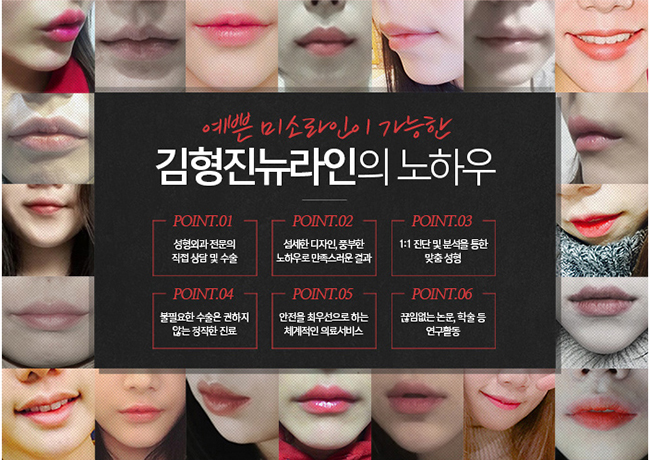 입꼬리필러가격이랑 후기 제대로 파헤치기! 관련 이미지 5