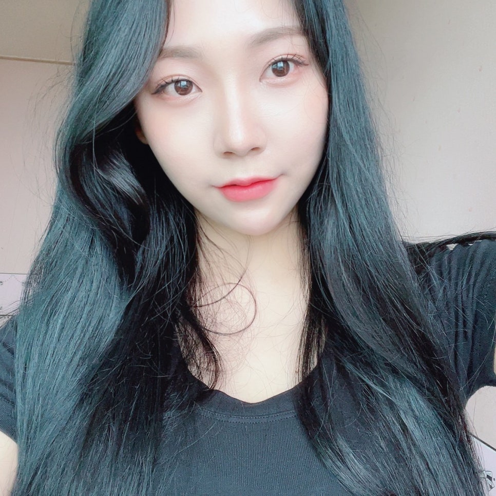 침샘보톡스전후 보고 바로 결정했어요 관련 이미지 2