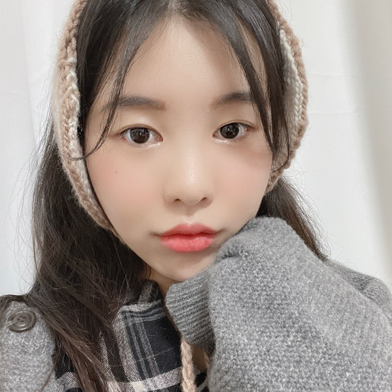 입꼬리필러잘하는곳 알아보고 계신다면? 관련 이미지 4