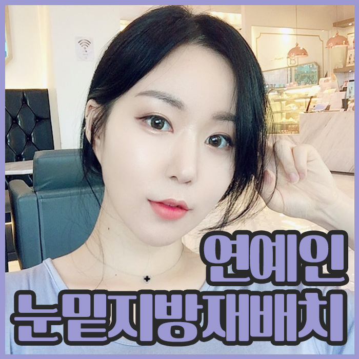 연예인눈밑지방재배치 이런 거구나 관련 이미지 1