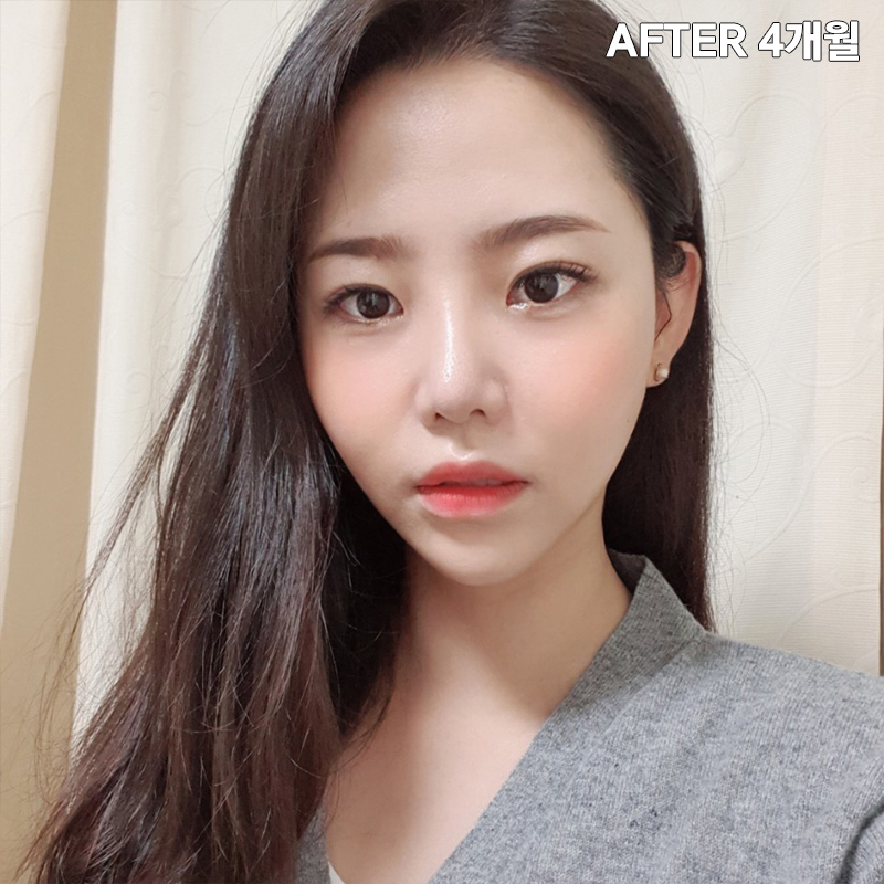 얼굴살빼는법! 전후 차이 확실하게 관련 이미지 6