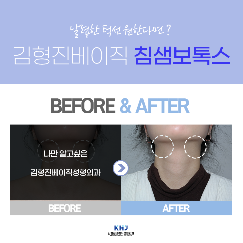 침샘치료도 역시 김형진베이직! 관련 이미지 6