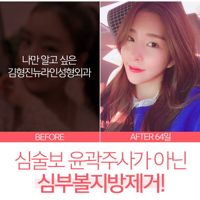 심술보윤곽주사 어림 없어요!! 관련 이미지 7