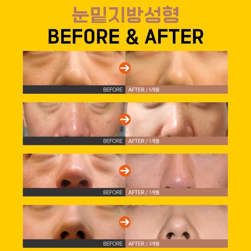 눈밑지효과 제대로 볼 수 있는 곳에서 해야죠 관련 이미지 5