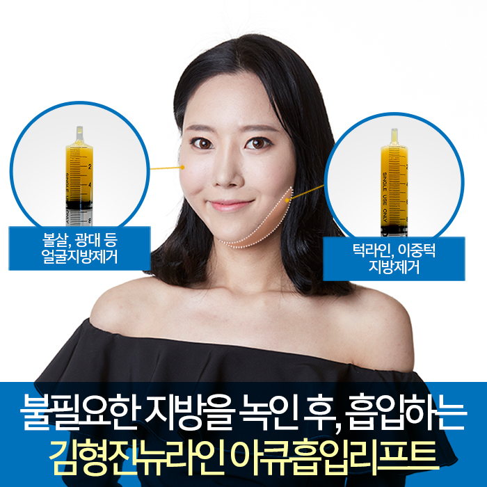 광대볼살제거 절대 어렵지 않아요 관련 이미지 4