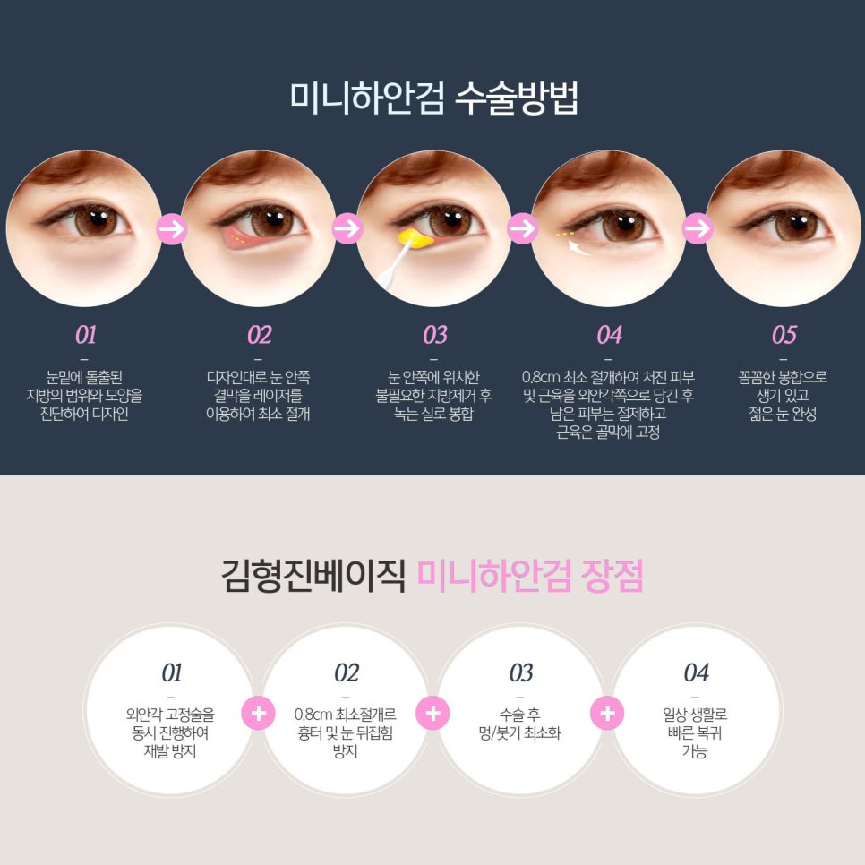 What Is the Difference Between Mini Lower Blepharoplasty and Under-Eye Fat Repositioning? image 5