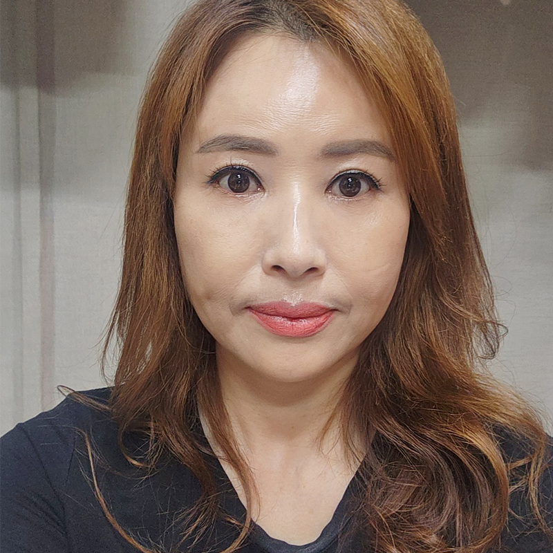 미니하안검효과 얼마나 좋냐면요 관련 이미지 1