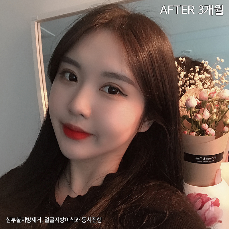 이중턱해결법 아직 모르신다구요? 관련 이미지 8
