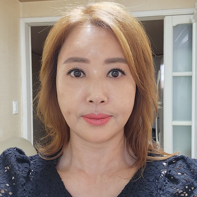 미니하안검절개 깔끔한 곳 찾으신다면 관련 이미지 1