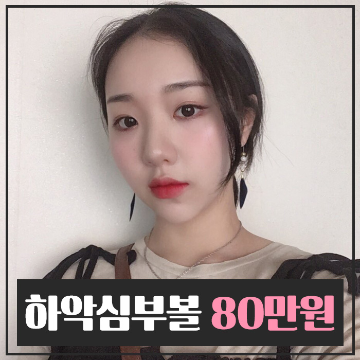 심부볼지방제거가격 싼 곳 보다는 실력이 중요! 관련 이미지 1
