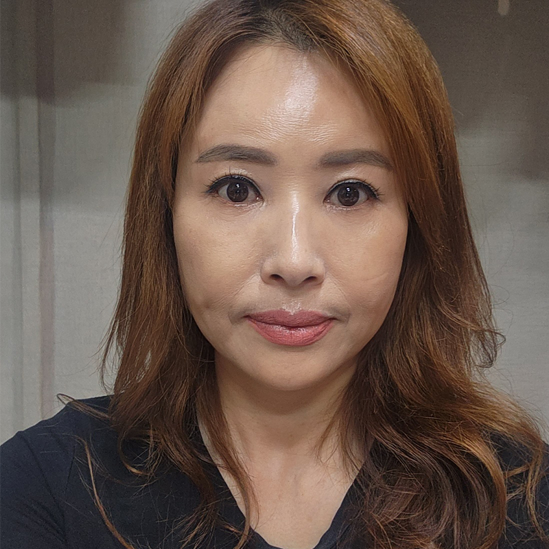 미니하안검수술 어떤 효과가 있냐면요 관련 이미지 1