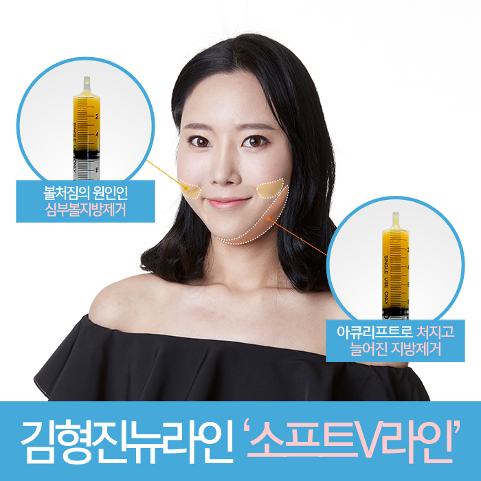 양악수술후볼처짐 두번 다신 없어야 해요 관련 이미지 4