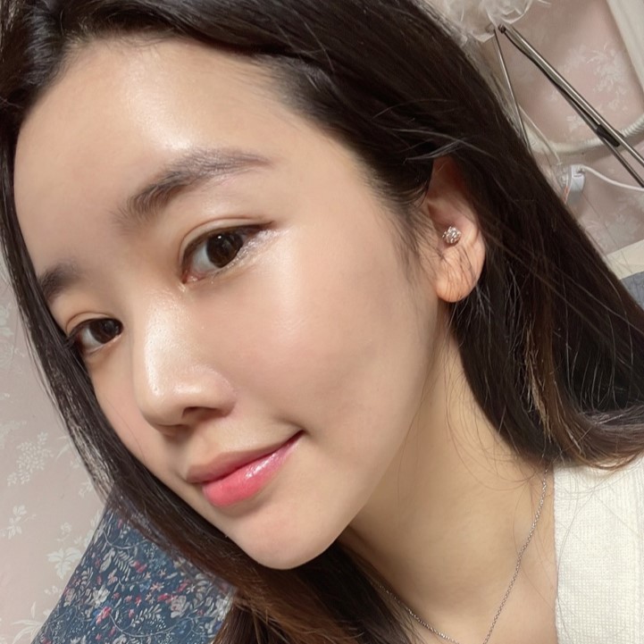 이중턱지방흡입만 하면 정말 어떤 각도에서도 날렵해 보일까? 관련 이미지 2