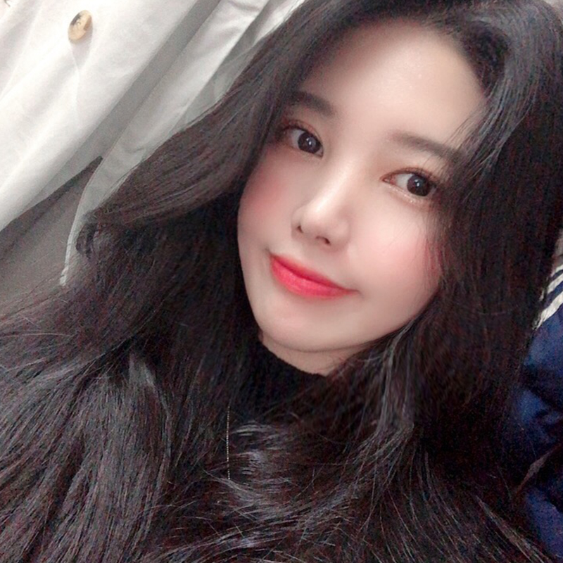 입꼬리필러유지기간 길 수 밖에 없는 김형진베이직 관련 이미지 2