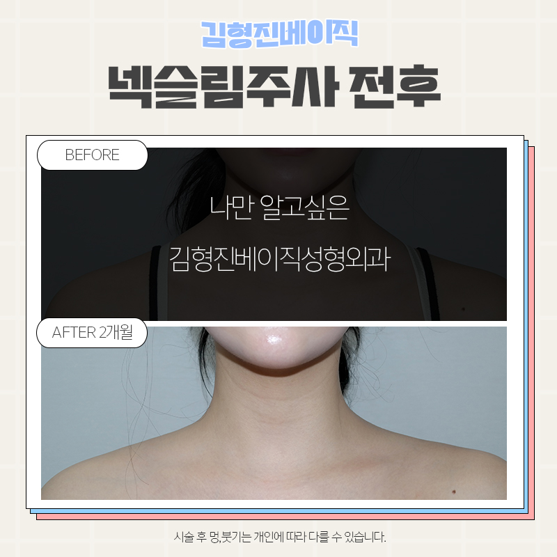 웨딩관리는 김형진베이직에서 하셔야죠! 관련 이미지 7