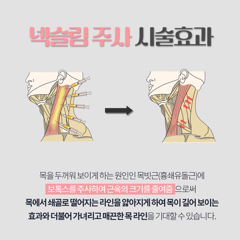 Nothing Works Better for Creating a Slim Neck image 4