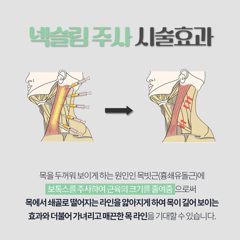 시간 없을 때 빠르게 목길어지는법 관련 이미지 4