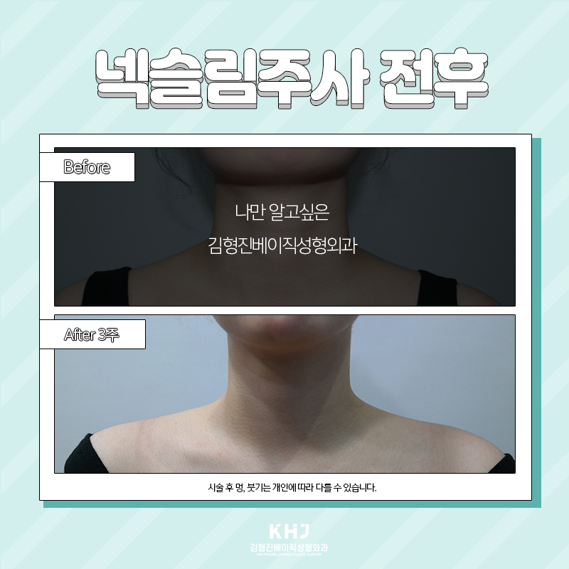 웨딩관리 김형진베이직에서 해야하는 이유 관련 이미지 3