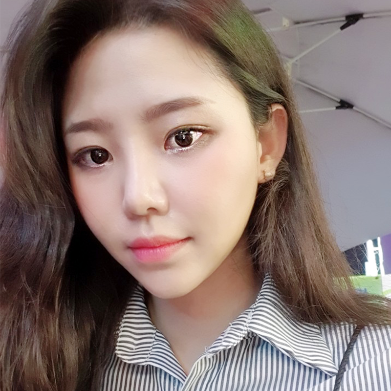 이중턱지방흡입흉터 걱정 되셨다면? 관련 이미지 2