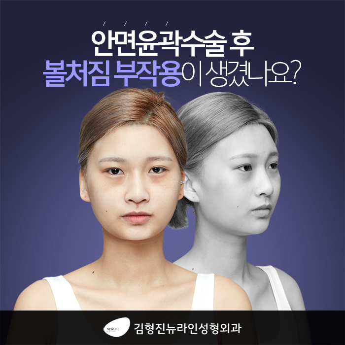 광대볼처짐 이렇게 해야 되요! 관련 이미지 1