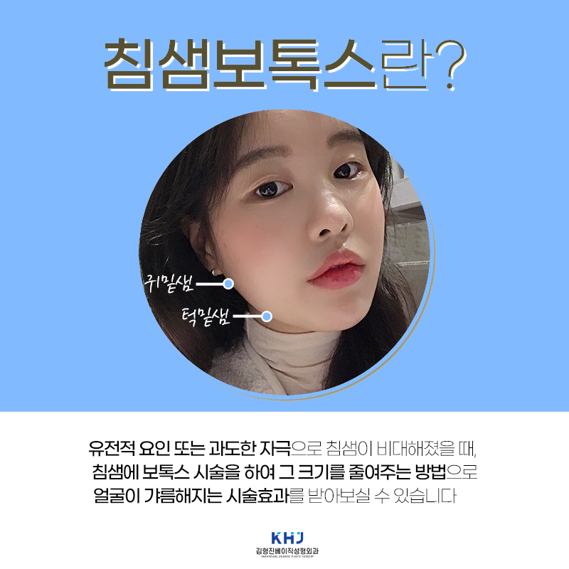 침샘비대증보톡스는 김형진베이직에서만 맞아요 관련 이미지 4