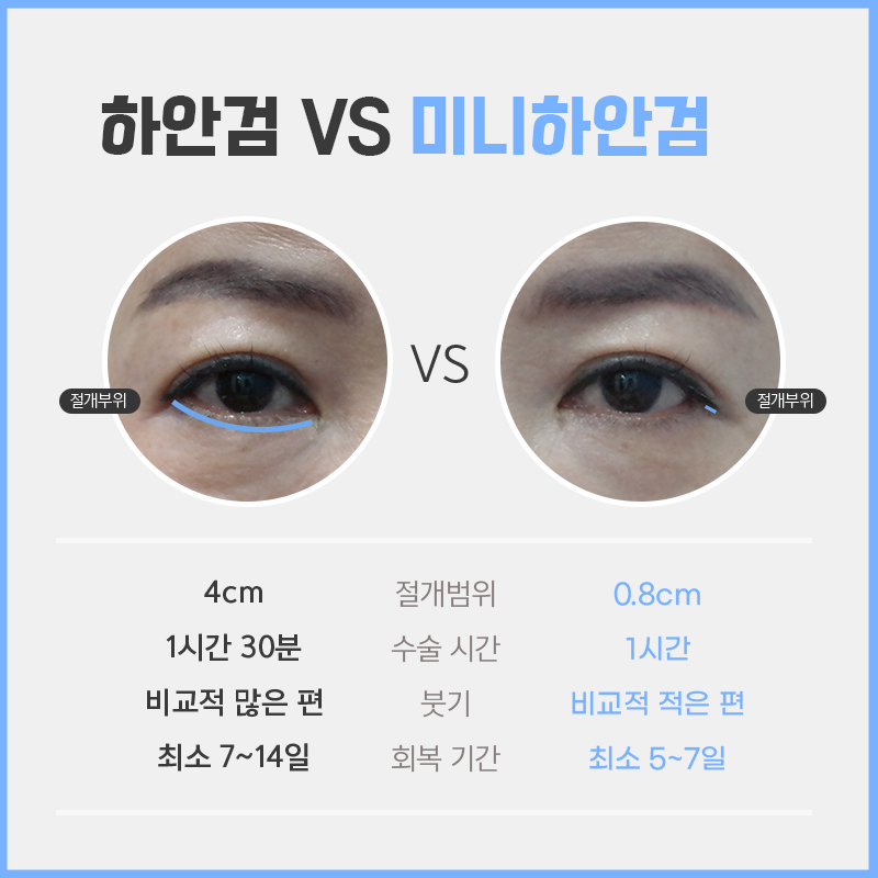 효도성형으로 젊음을 되찾아드리고 싶다면? 관련 이미지 6