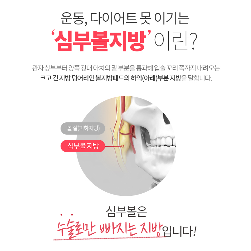 심부볼지방제거수술로 처진 불독살 개선 끝 관련 이미지 2