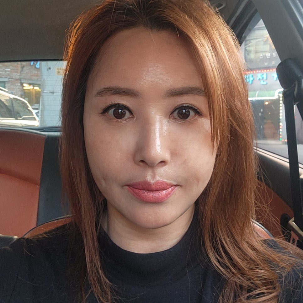 중년눈성형후기 눈 밑이 달라지니까 인상이 확 바뀌었어요 관련 이미지 2