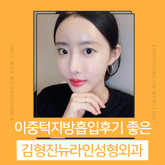 이중턱지방흡입후기 솔직하게 관련 이미지 1