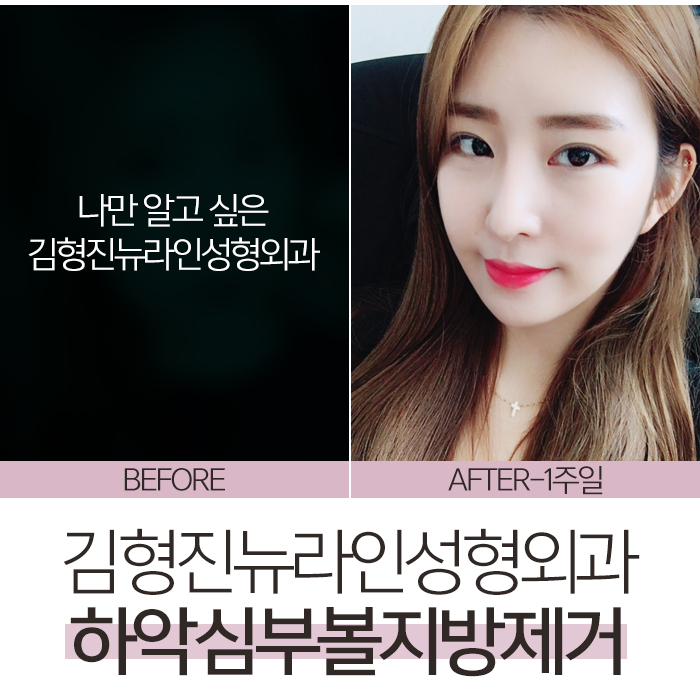 볼씹힘 심하다면, 이게 해결책! 관련 이미지 7