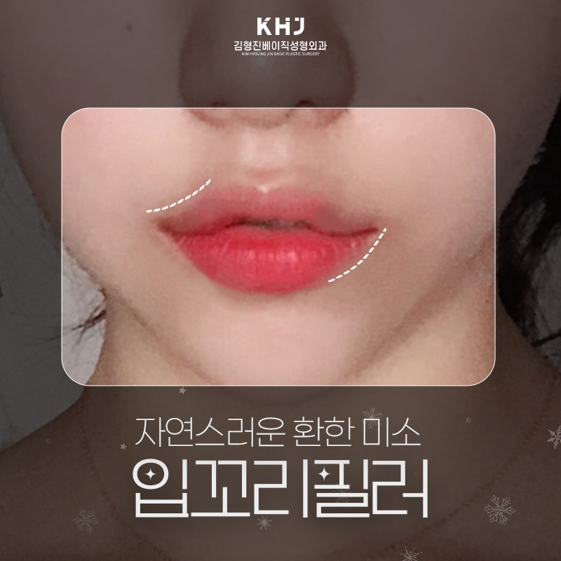 입꼬리필러모양 세심하게 잡아주는 곳 찾으신다면? 관련 이미지 2