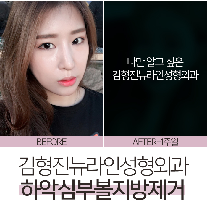 볼씹힘 심하다면, 이게 해결책! 관련 이미지 1