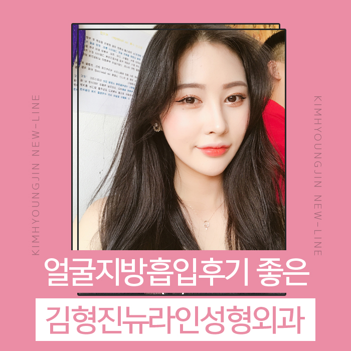 얼굴지방흡입후기 완벽 변신! 관련 이미지 1