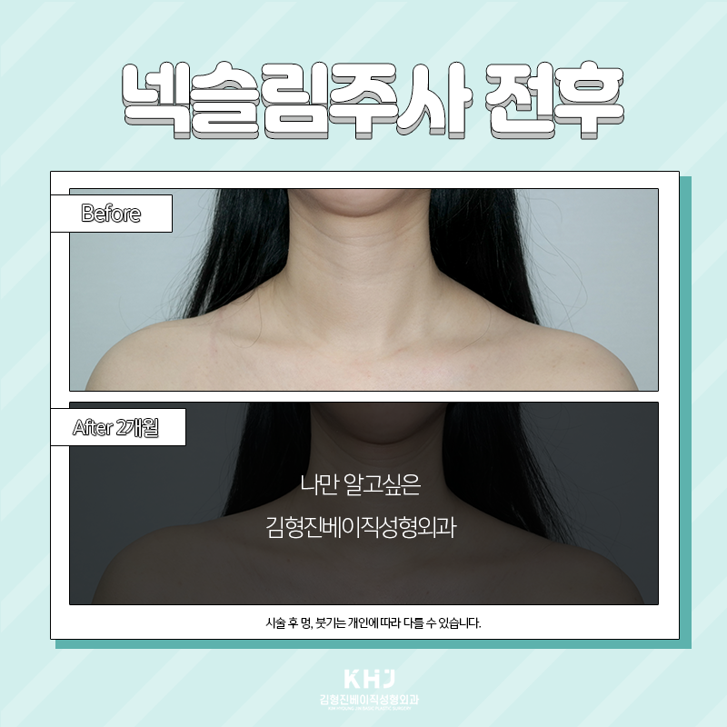 웨딩관리 뭐 해야 할지 고민된다면? 관련 이미지 4