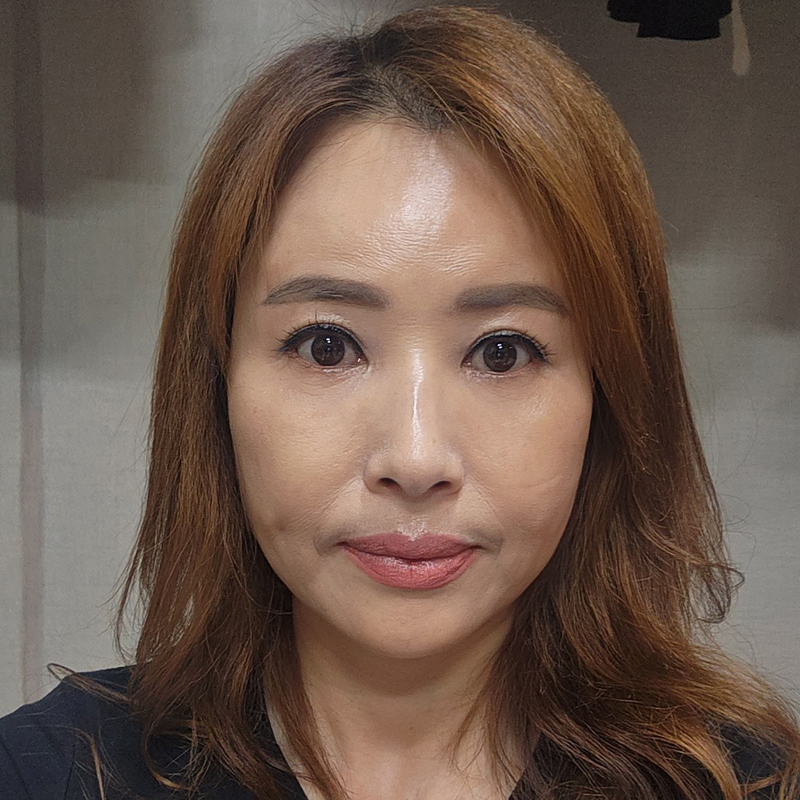 중년눈밑수술 잘하는 김형진베이직 관련 이미지 1