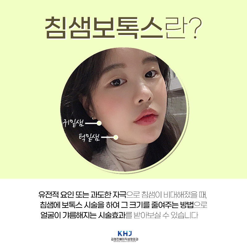 침샘비대증 치료하고 날렵한 턱선 만들었어요! 관련 이미지 4