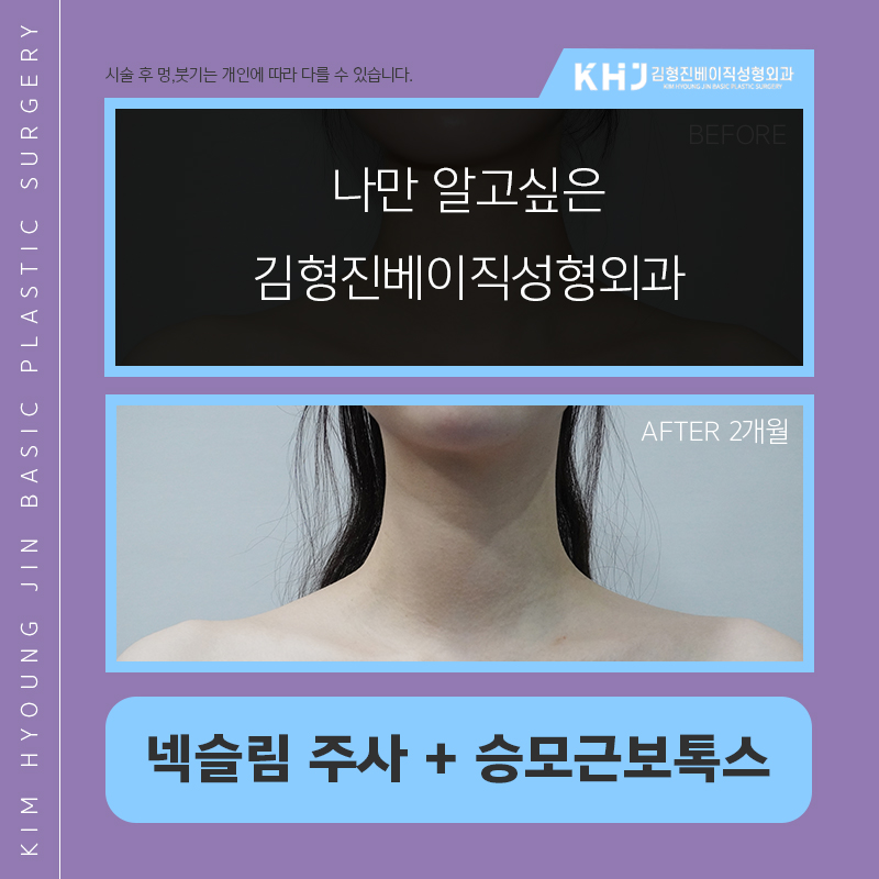 목보톡스 진짜는 김형진베이직인거 아시죠 관련 이미지 3