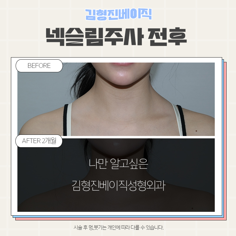 웨딩관리는 김형진베이직에서 하셔야죠! 관련 이미지 6