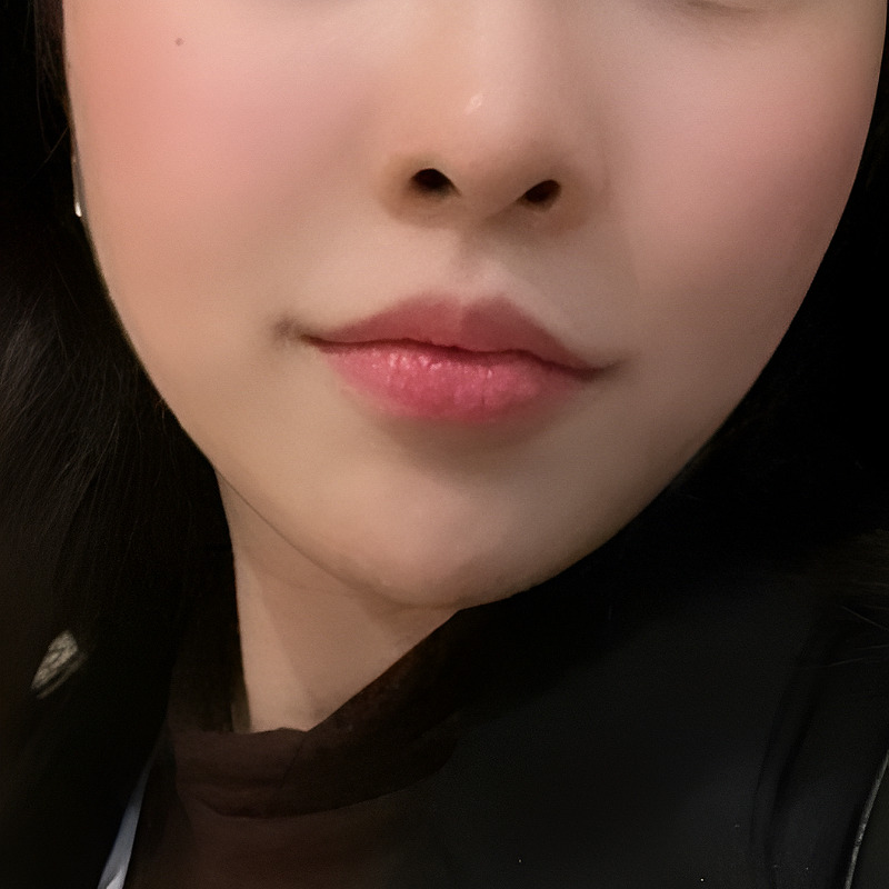 강남입꼬리필러추천 부드럽고 생기 있는 미소 만들기 관련 이미지 2