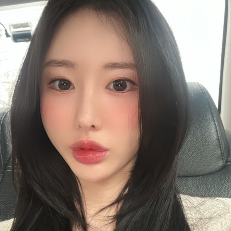 I Had Under-Eye Fat Repositioning, and Everyone Says It Turned Out Neat and Beautiful! image 1