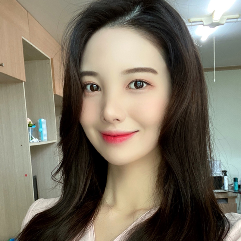 입꼬리필러시술 할 수 밖에 관련 이미지 3