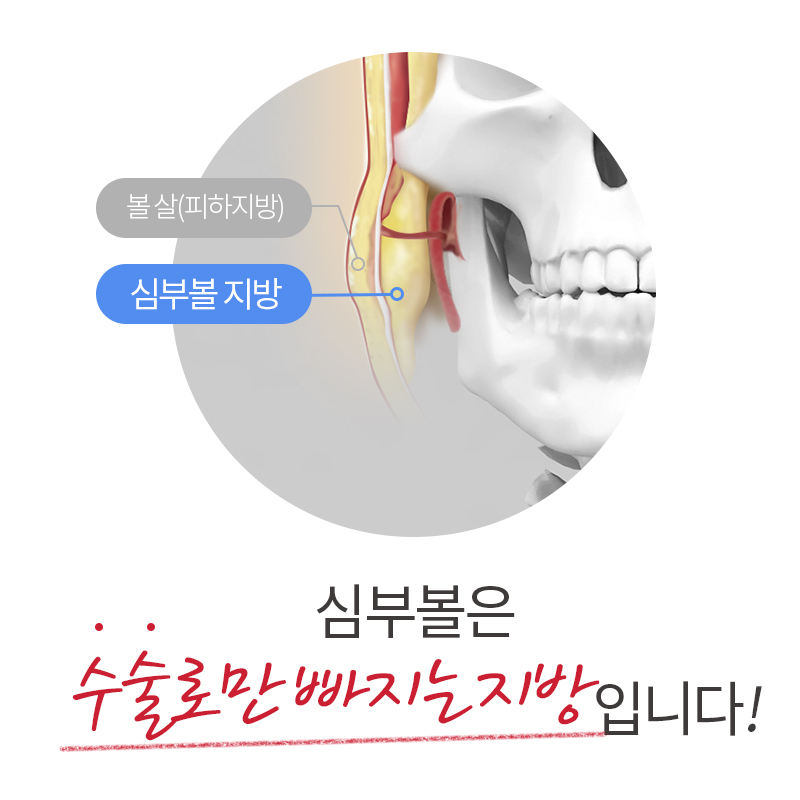 심부볼리프팅으로 해결가능하냐구요? 관련 이미지 2