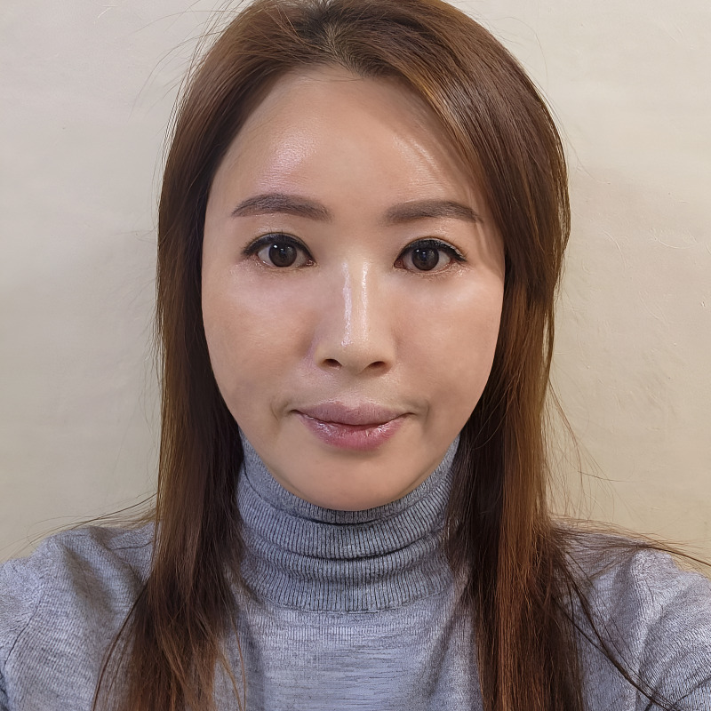 중년하안검 아무거나 하지 마세요 관련 이미지 2