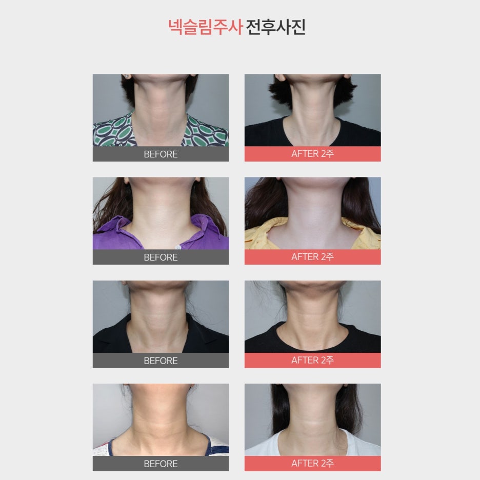Nothing Works Better for Creating a Slim Neck image 5