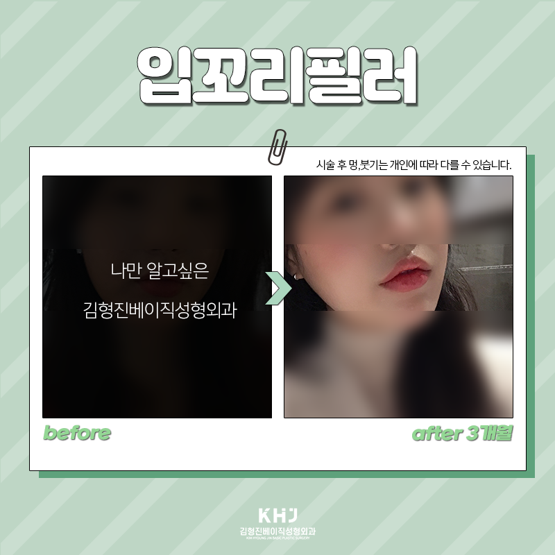 처진입꼬리 개선방법 이렇게나 간단해! 관련 이미지 6